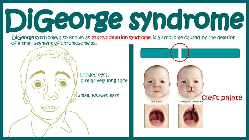 Anatomic Defects And Immunodeficiencies - Pharmacy Gyan