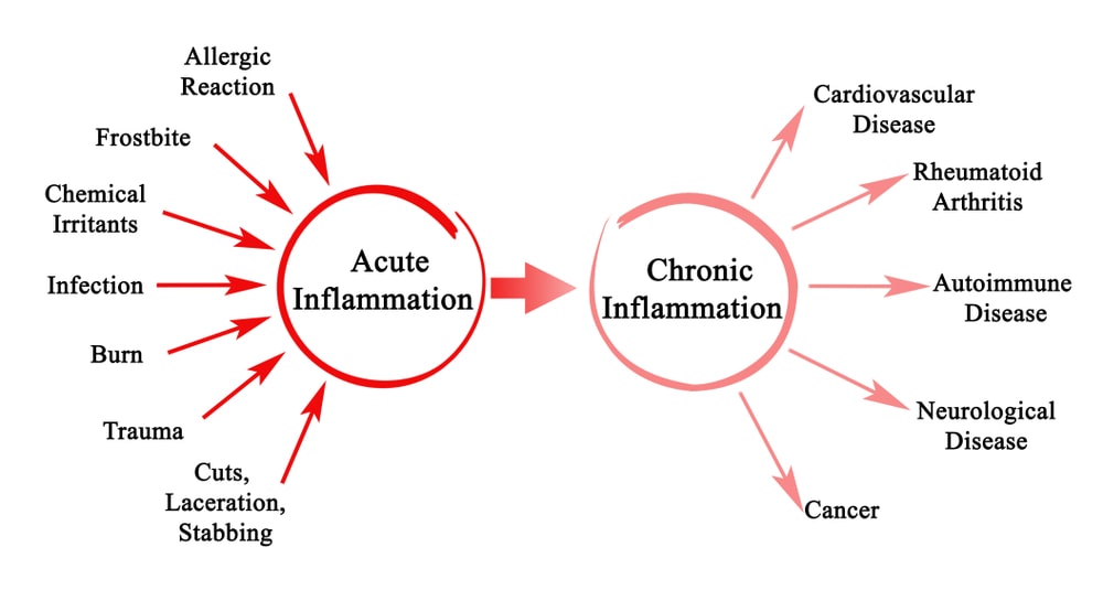 Different Types Of Inflammation Pharmacy Gyan Pathophysiology