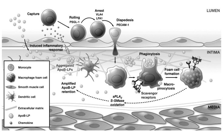 Mechanism of atherosclerosis 