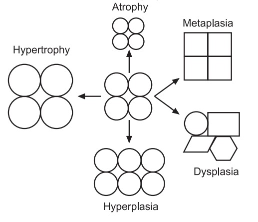 Morphology of cell injury adaptive changes